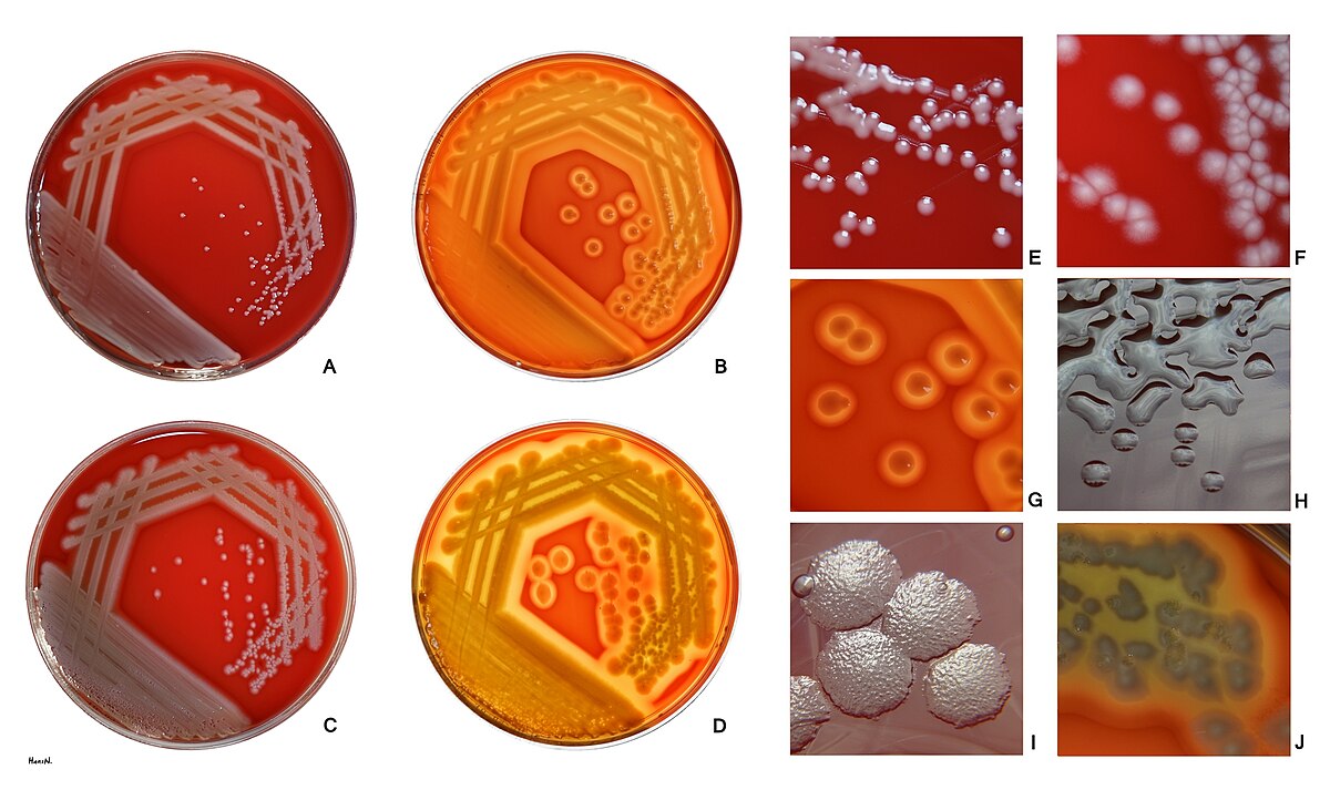 image_search_1720444476714 Pseudomonas aeruginosa